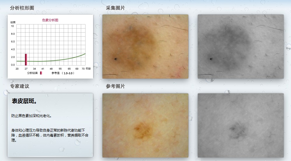 皮膚測試儀 科學(xué)護膚的智能助手
